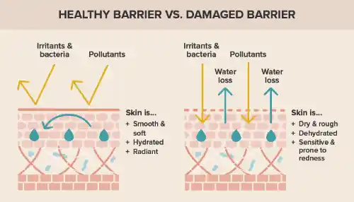 skin barrier illustration